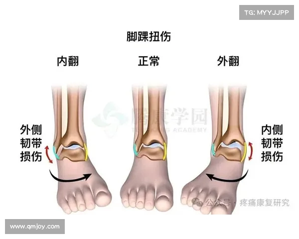 毛伟杰右踝韧带撕裂与损伤预计恢复期为五至六周 毛伟杰右踝韧带撕裂与损伤预计恢复期为五至六周